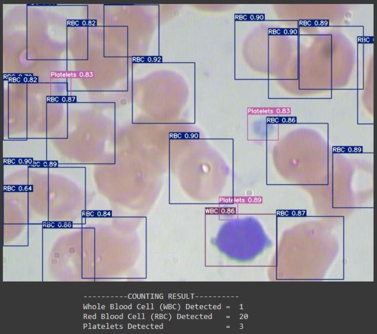 Blood cell detection result using YOLOv7