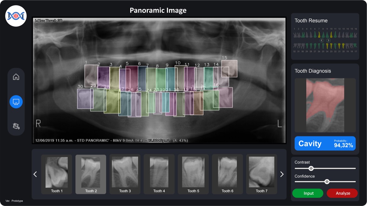 Dental diagnosis graphical interface design