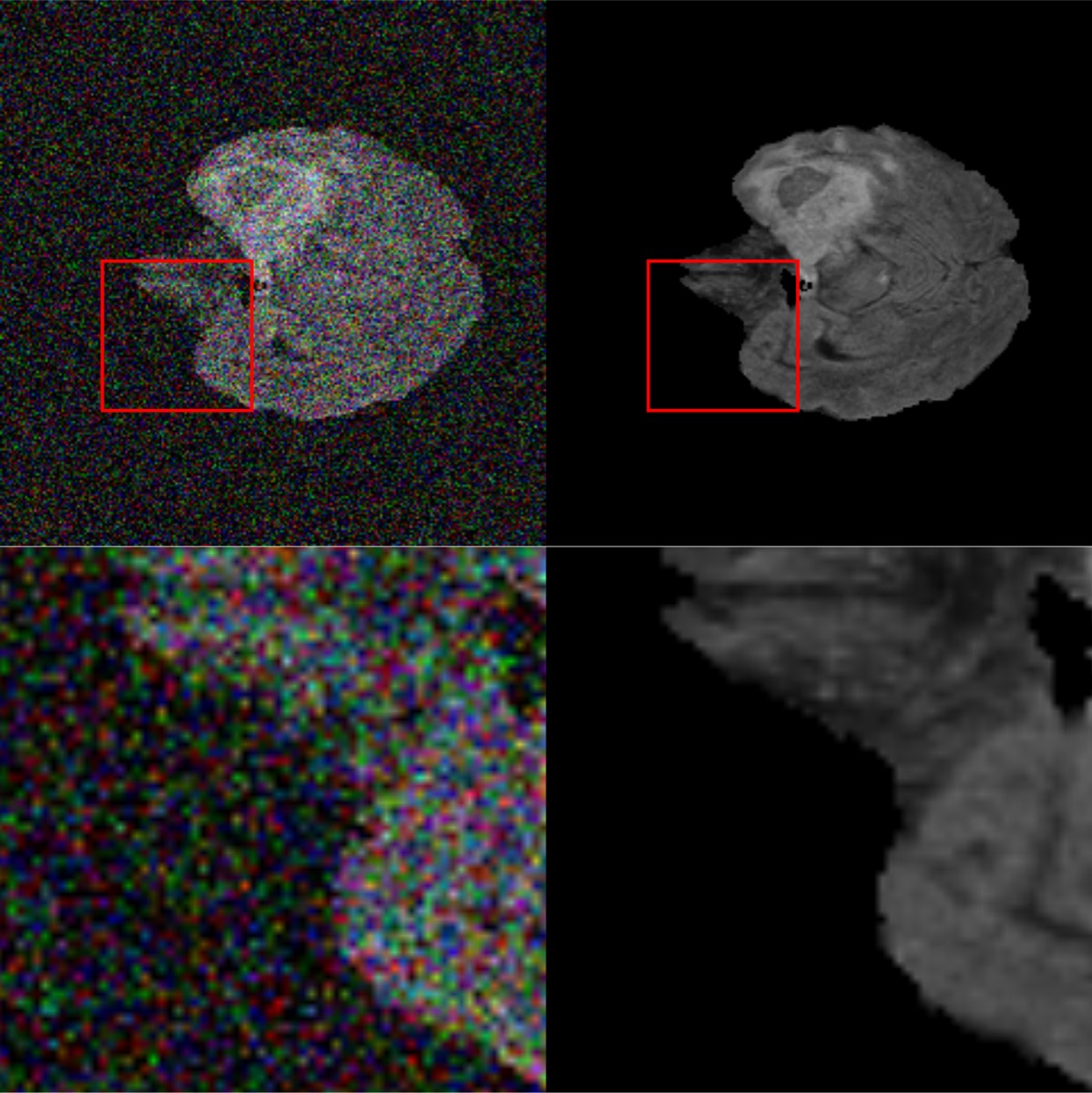 MRI and CXR denoising result comparison